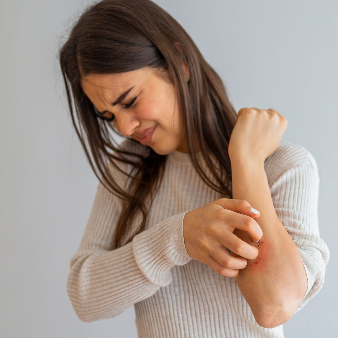 Dermatite atopica: come proteggere la pelle durante l’inverno