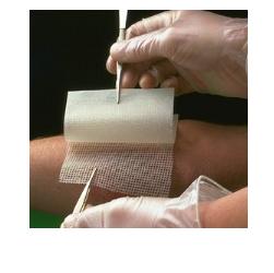 GARZA MEDICATA BACTIGRAS CON CLOREXIDINA ACETATO 0,5% 10X10CM 10 PEZZI - farmasorriso.com